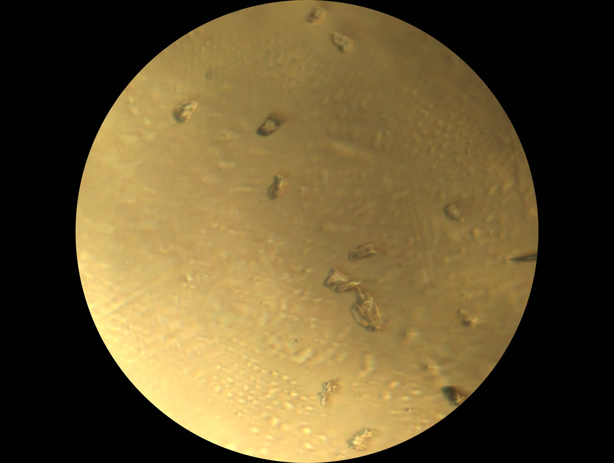 A golden microscope field with scattered eggs trapped in the device