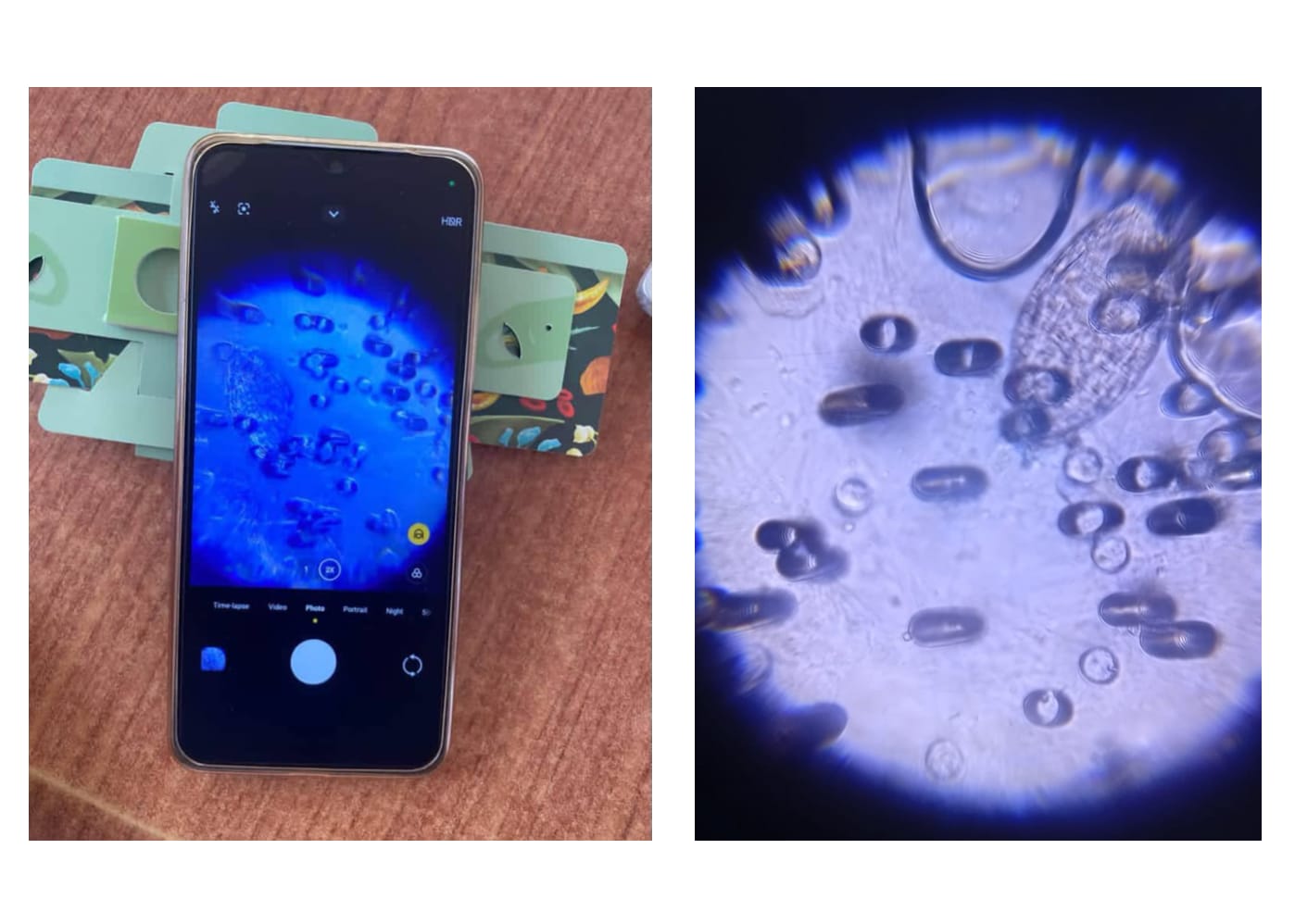 A smartphone mounted on a Foldscope shows schistosome eggs, beside a close-up of the eggs on the filter