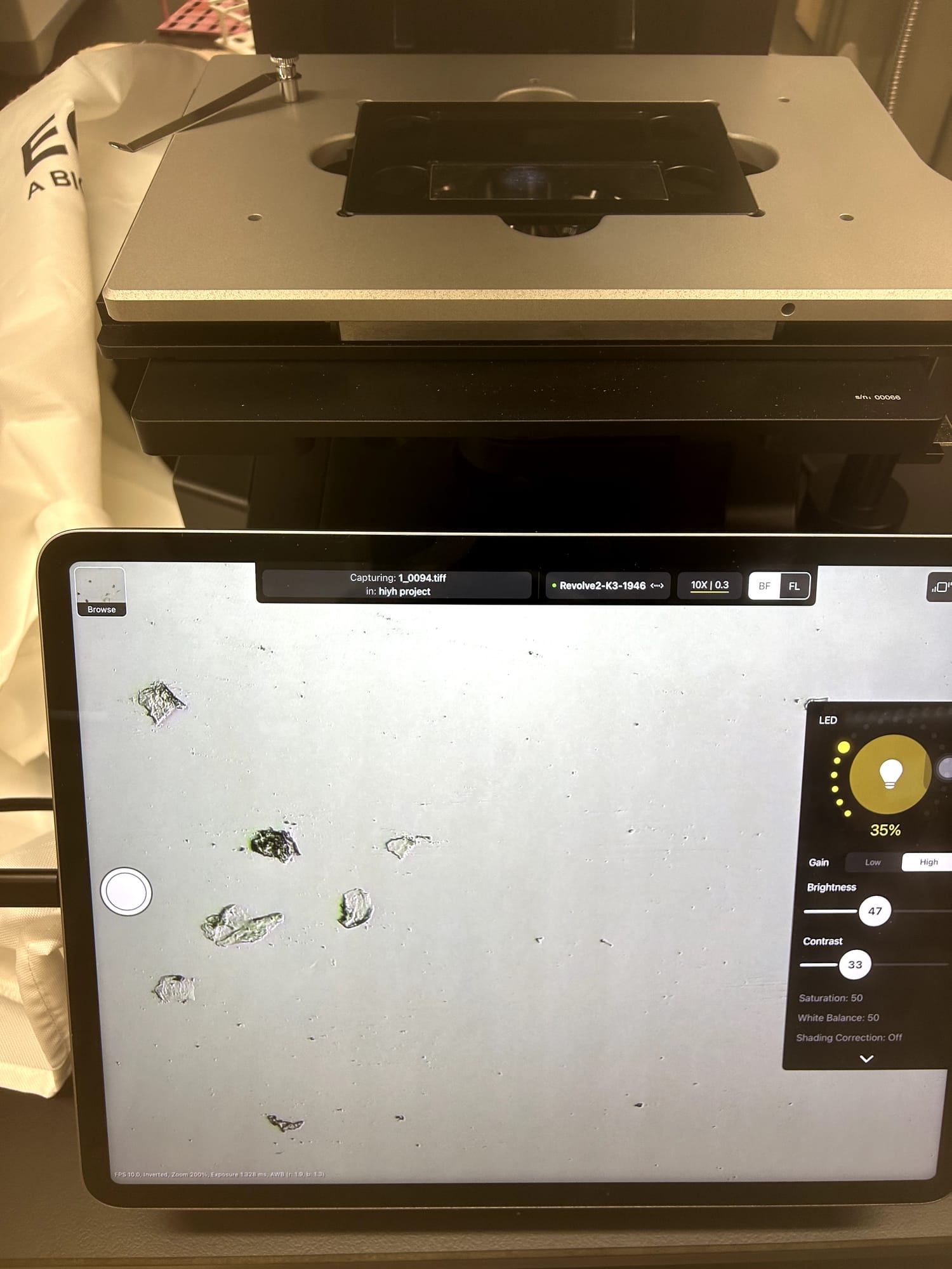 A tablet displaying a microscope image with several eggs still visible on the coverslip