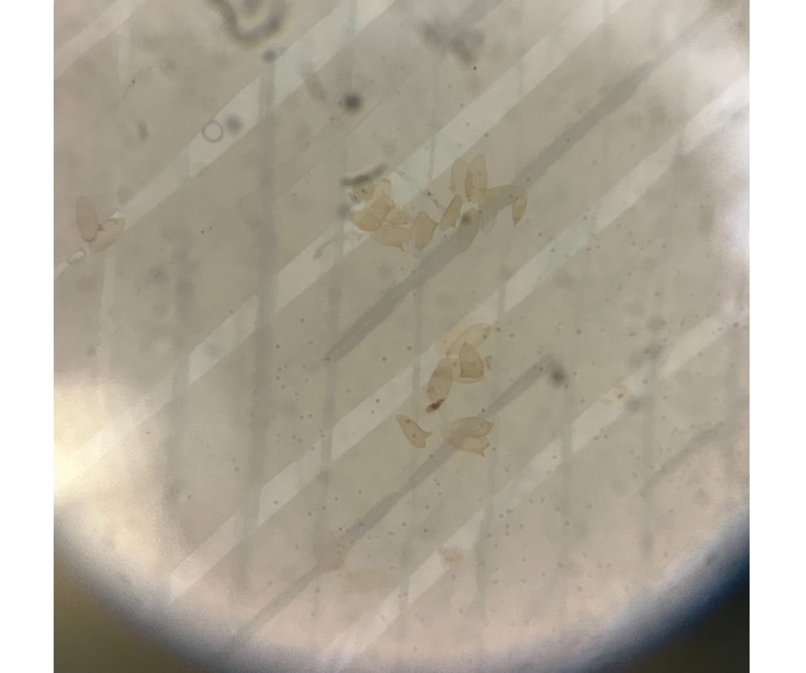 A microscope field showing eggs captured after filtering through the white-printed Staircase Cell