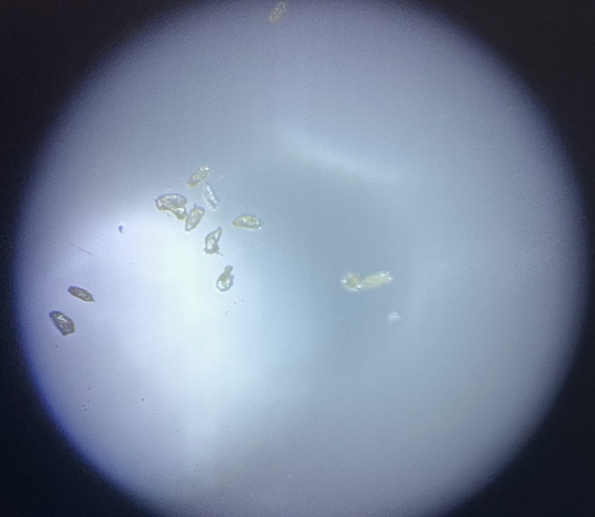Schistosome eggs seen through the fish-eye lens in a bright circular field